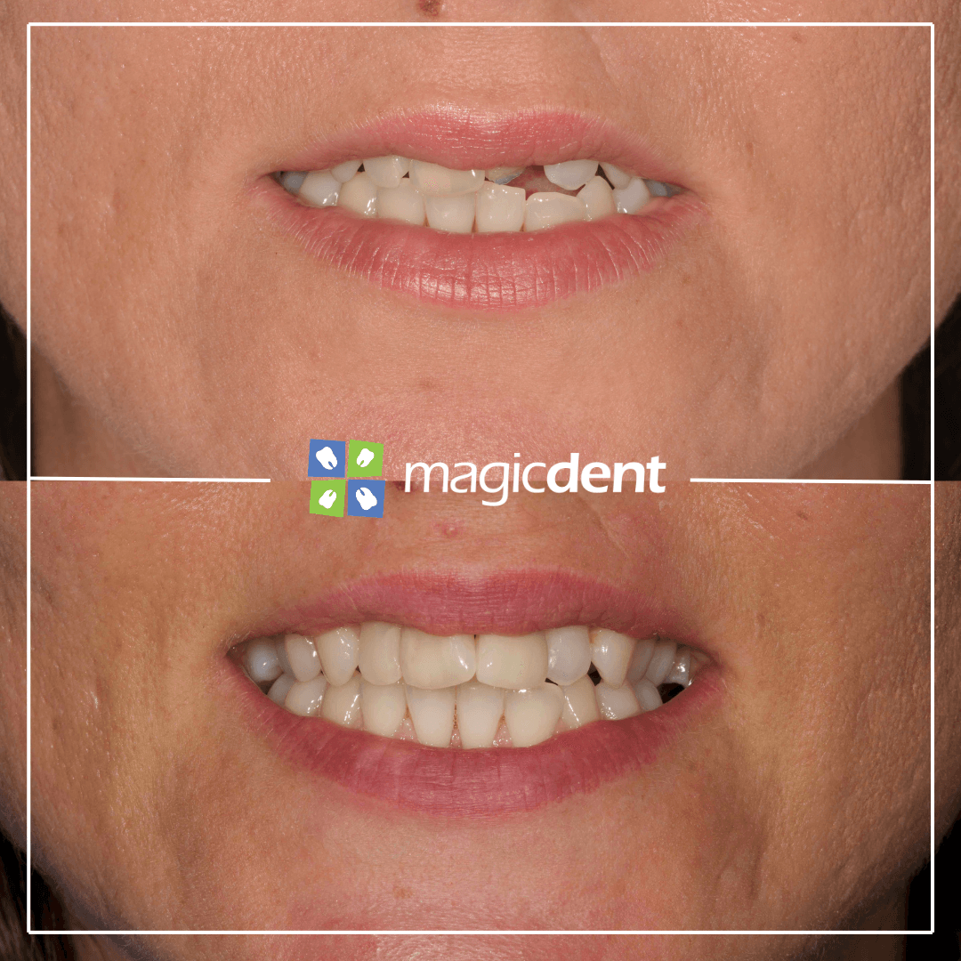 Ništa ne može ostaviti prvi bolji utisak od lepog osmeha!