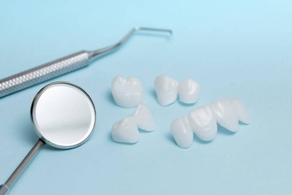 Zubne fasete se koriste za ulepšavanje osmeha